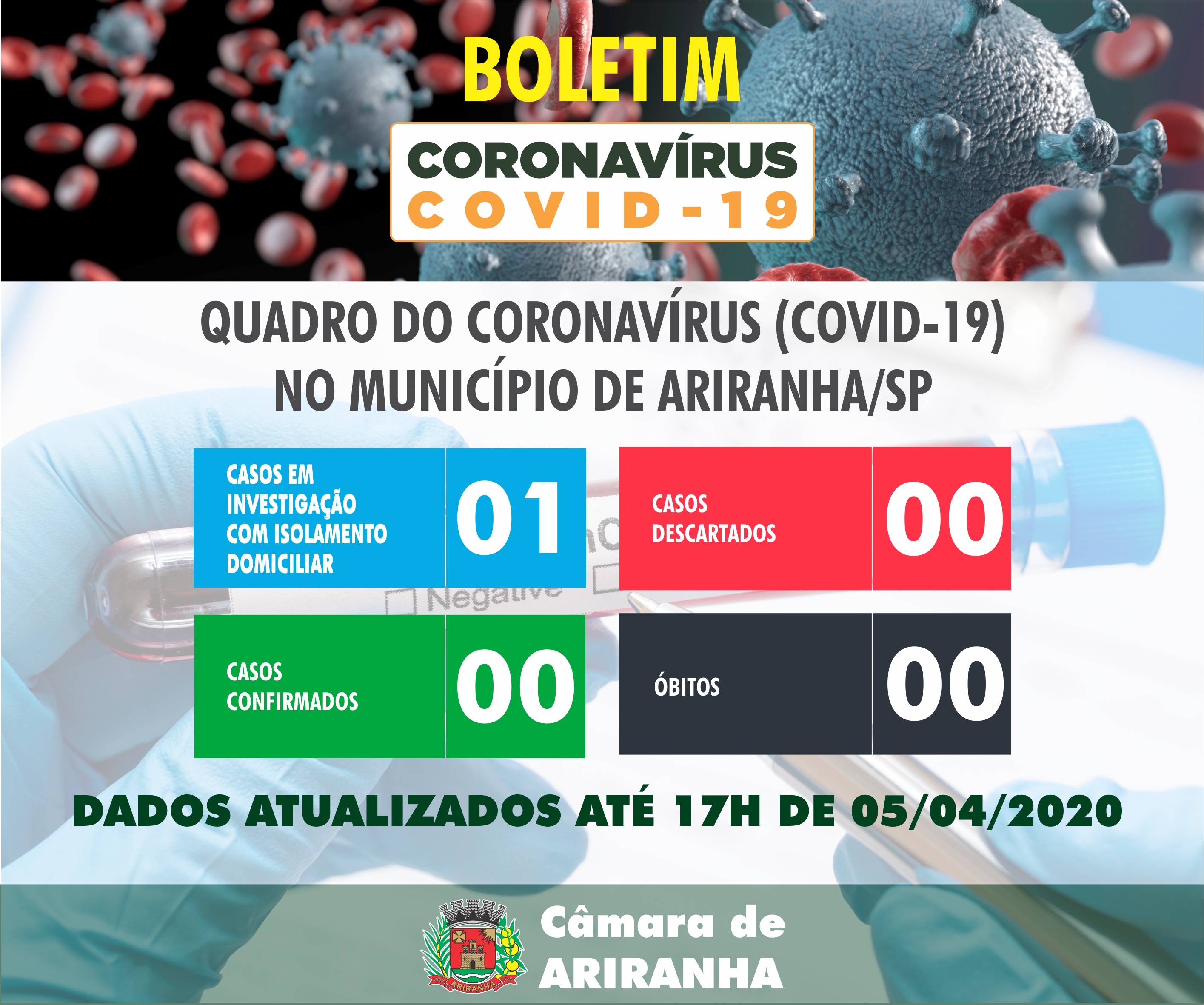Boletim diário Corona Vírus (COVID-19) – 05/04/2020